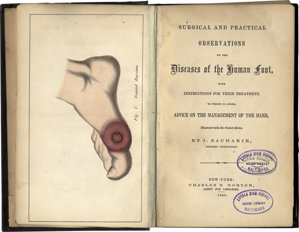 Issachar Zacharie’s Surgical and Practical Observations on the Diseases of the Human Foot, 1860. (Courtesy of the Shapell Manuscript Collection.)